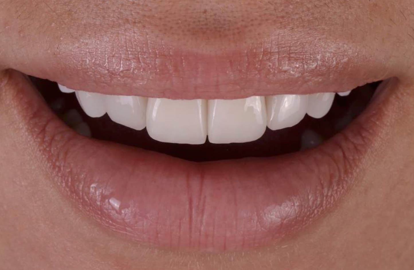 alt-alexandre-gallery-cases-01