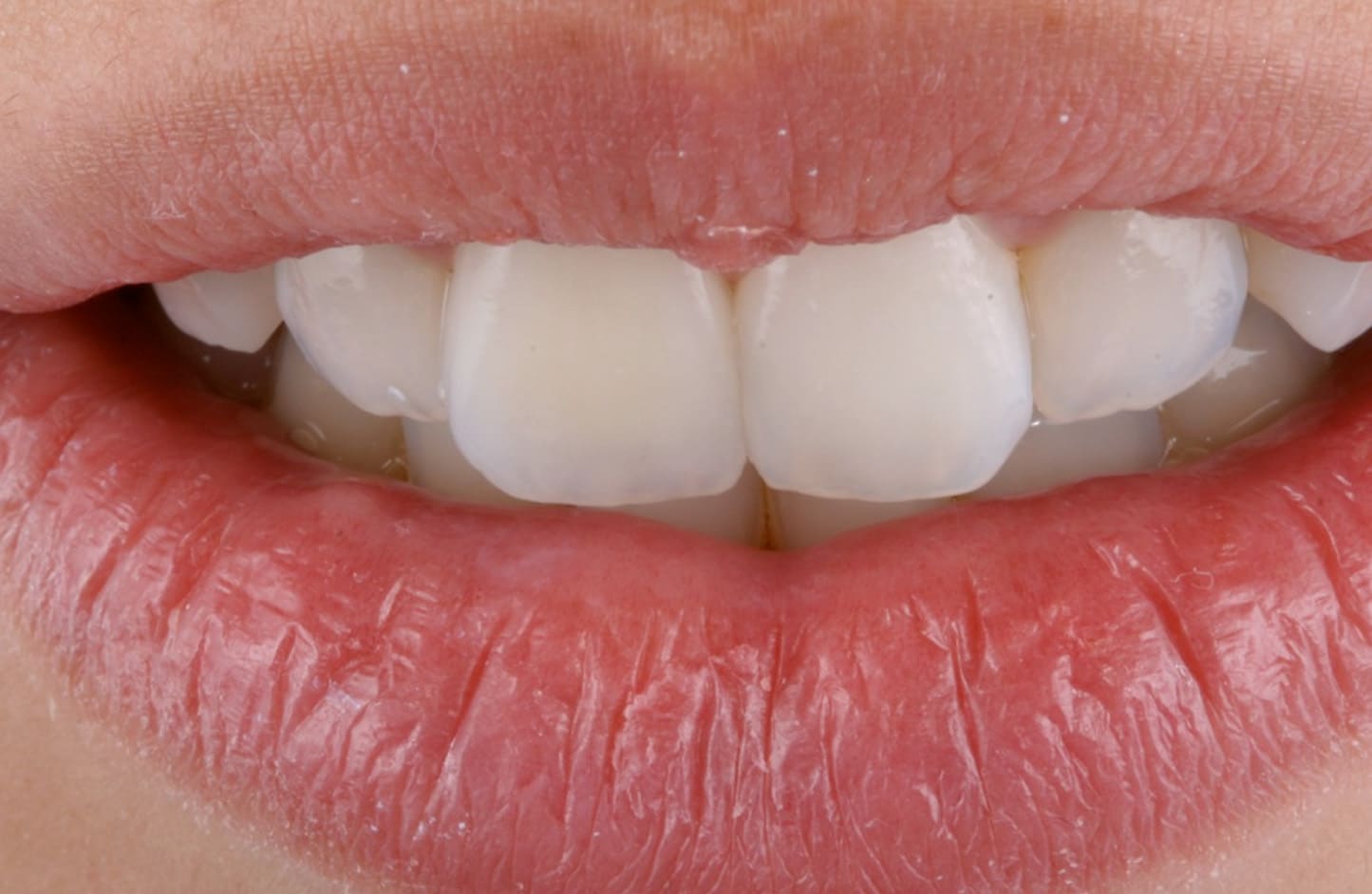 alt-alexandre-gallery-cases-02