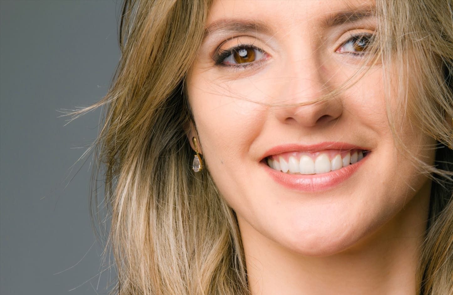 alt-alexandre-gallery-cases-03-2