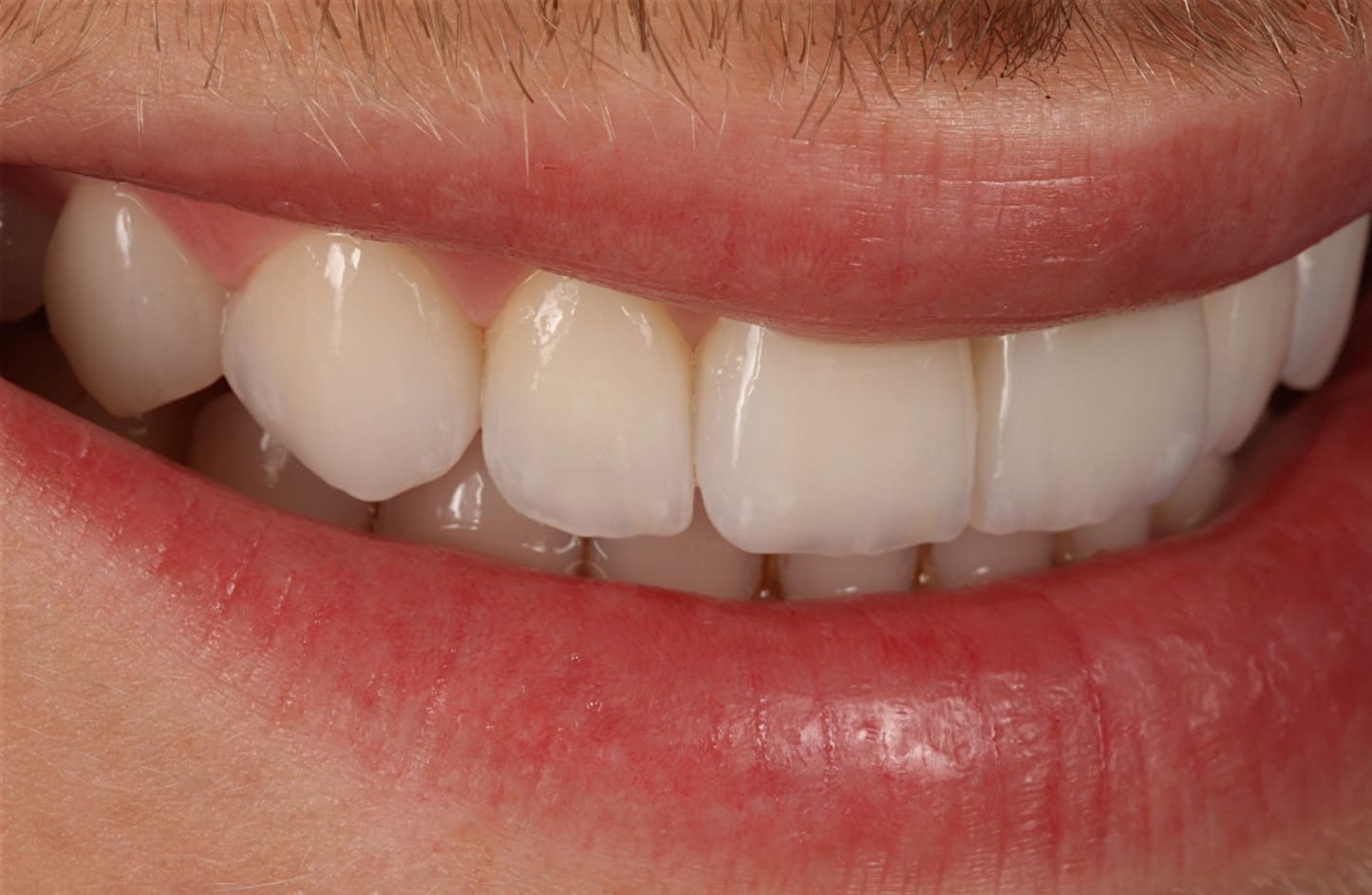 alt-alexandre-gallery-cases-04