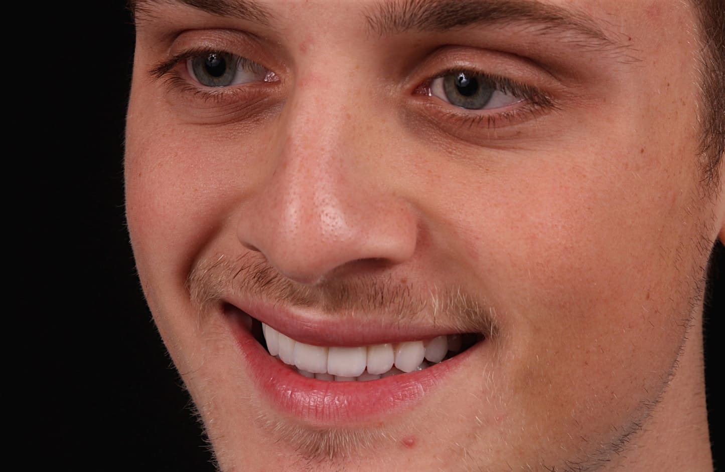 alt-alexandre-gallery-cases-05-2