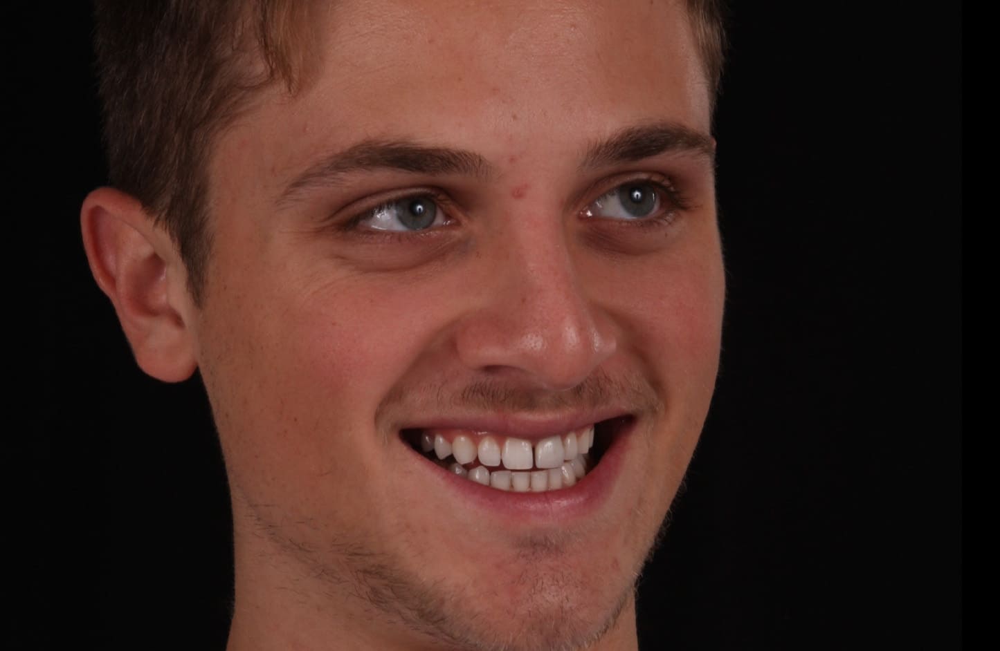 alt-alexandre-gallery-cases-05