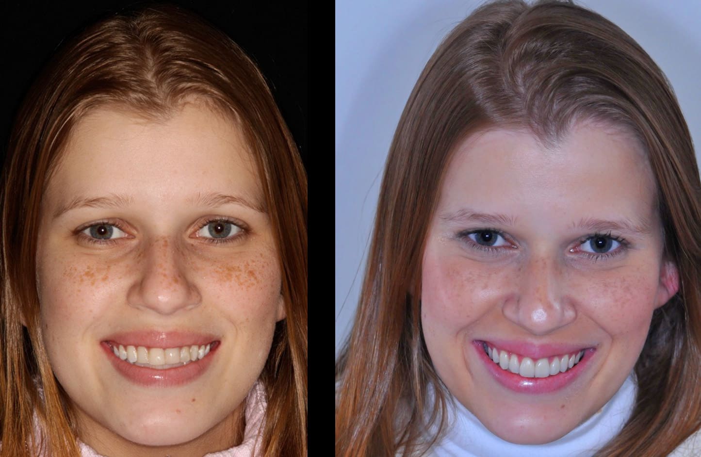 alt-alexandre-gallery-cases-08