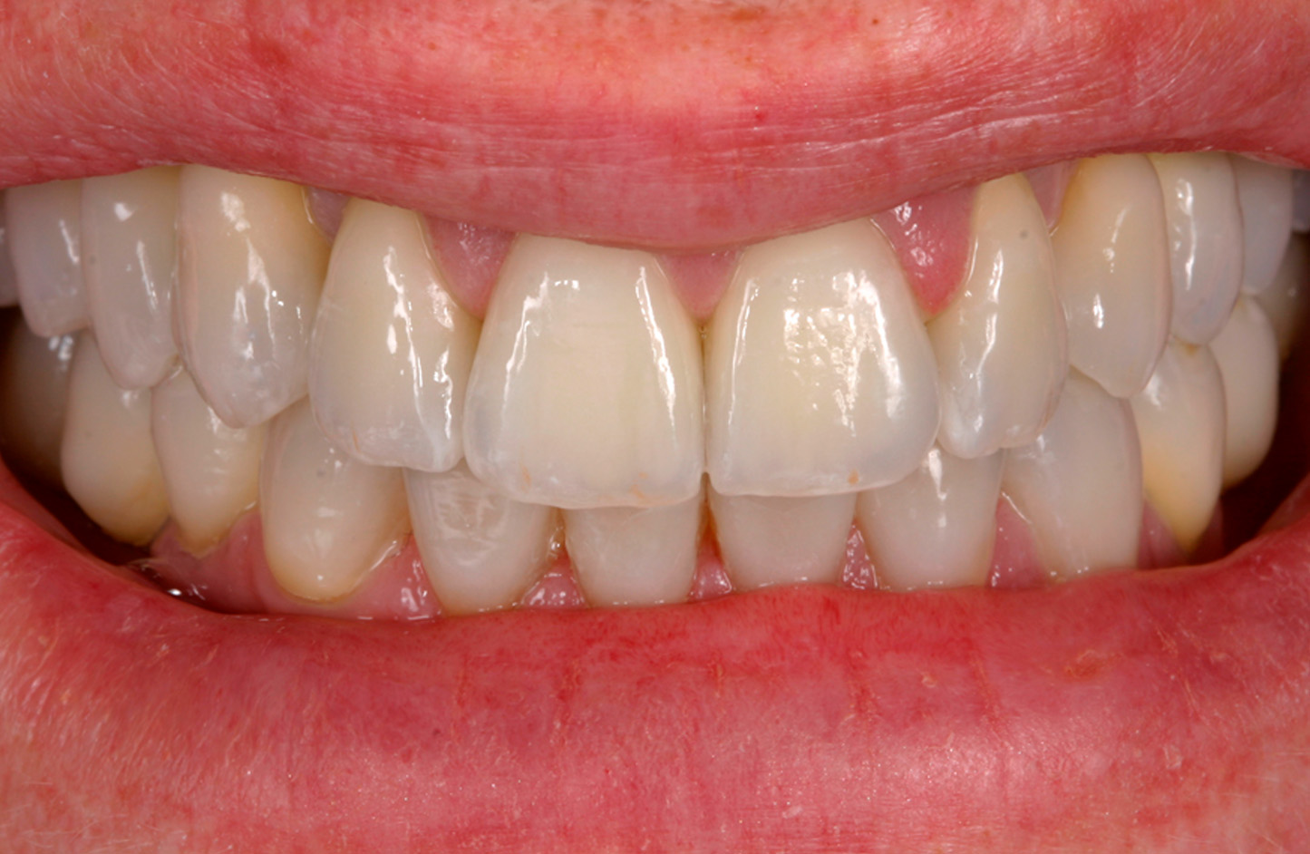 alt-alexandre-gallery-cases-10